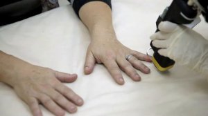 Лазерное лечение грибка ногтей (онихомикоза) в клинике Gold Laser