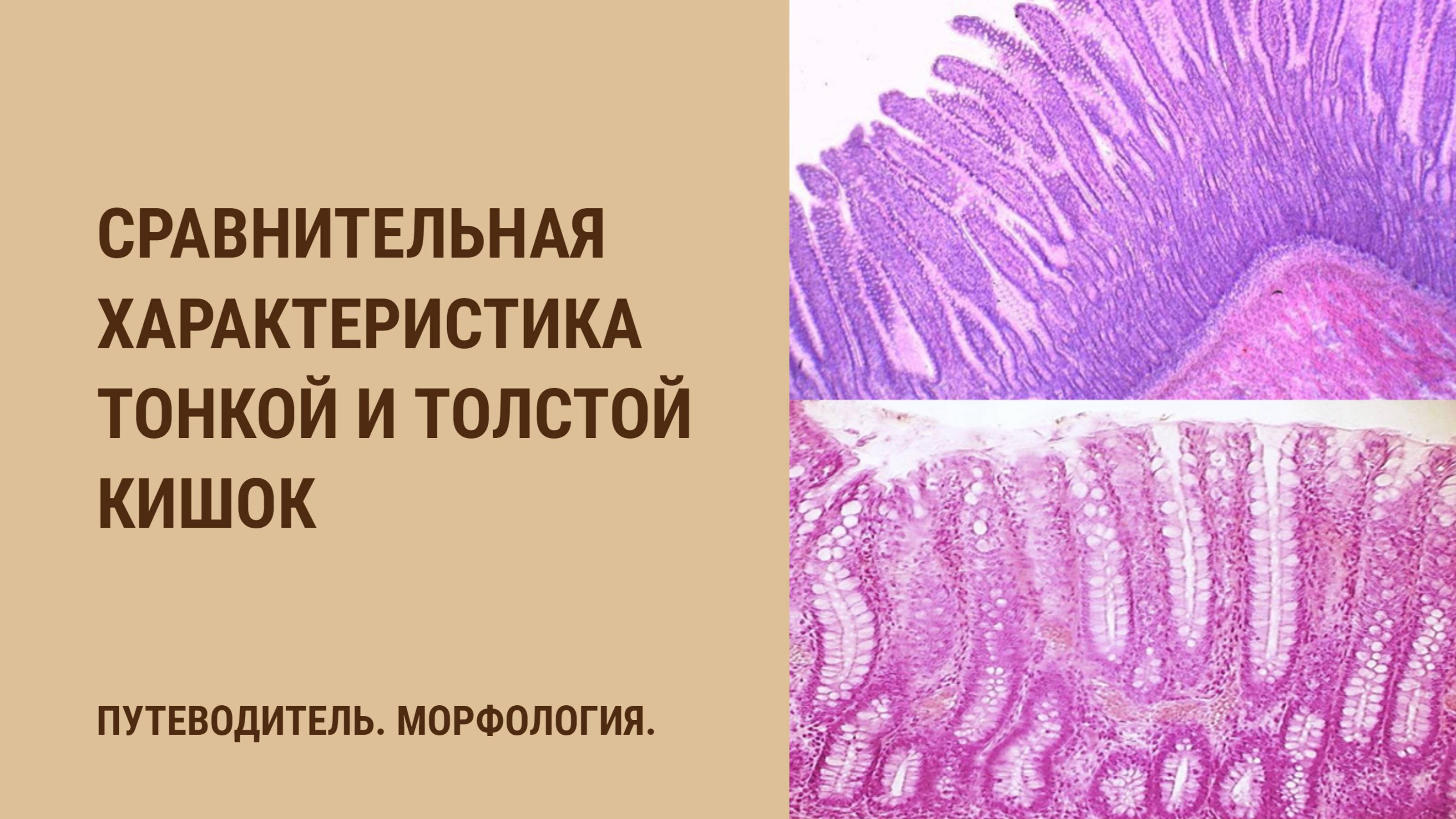 Сравнительная характеристика тонкой и толстой кишок смотреть онлайн
