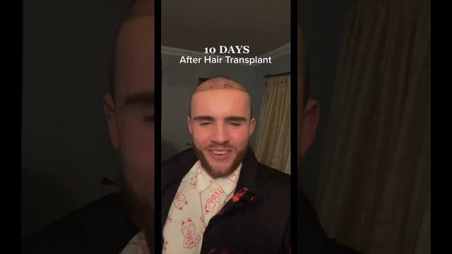 Hair Transplant Results ! смотреть онлайн