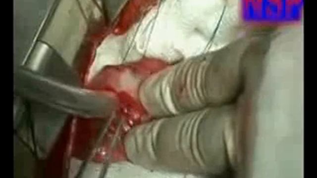 Здесь расскажут, как кого паразиты кушают на завтрак, обед и ужин!