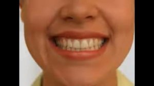 Занятия с логопедом - упражнение "Лягушка"