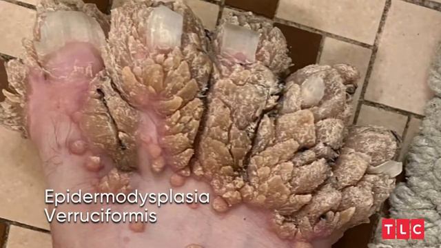 Why People are ADDICTED to Watching My Feet Are Killing Me! смотреть онлайн