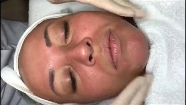 Механическая чистка лица. Баку смотреть онлайн
