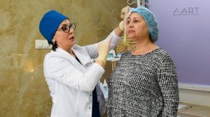 Коррекция "FULL FACE" филлерами DELIGHT®