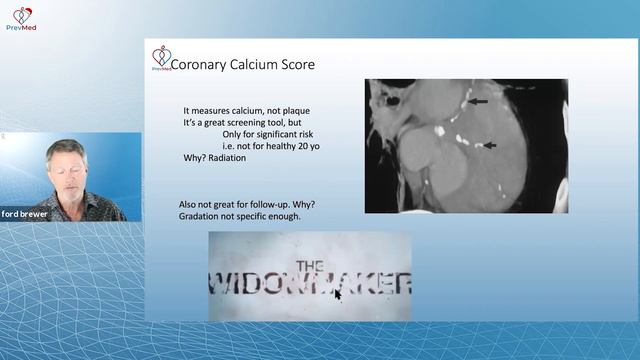 Coronary Calcium Score - How Your Score Relates to Heart Disease Risk смотреть онлайн