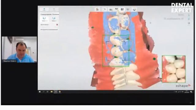 Наумов Виталий   Клинические секреты работы с винирами    препарирование и изготовление временных в