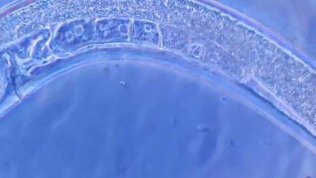Нематода. 1000х Фазовый контраст // Nematode. 1000x phase contrast смотреть онлайн