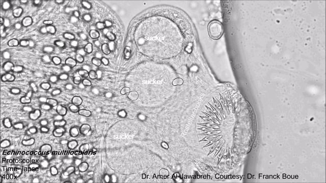 Echinococcus multilocularis protoscolex in hydatid cyst. Time lapse смотреть онлайн