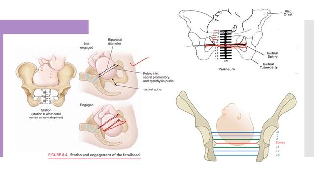 Mechanism of Labour - English смотреть онлайн