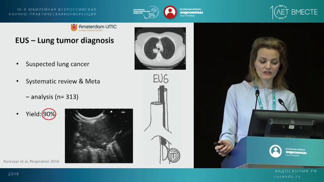 EBUS And EUS In Mediastinum – From Sarcoidosis To Lung Cancer