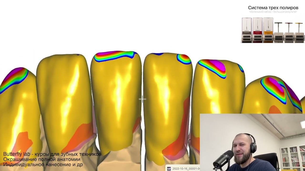 Exocad 3.1 rijeka modelling dental cad exocad video exocad Video Tutorial. Моделирование в exocad смотреть онлайн