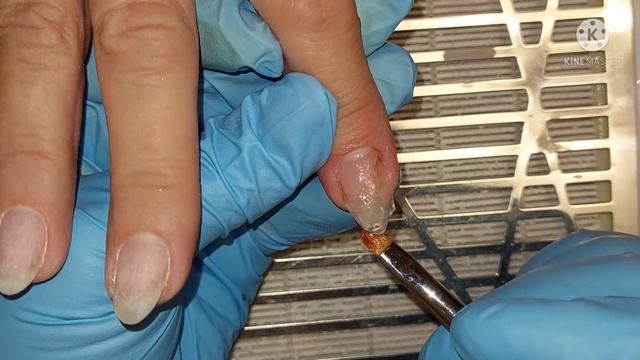 НОГТЯМ 60 ДНЕЙ ?? Последствия переношеного покрытия ? сюрпризы под покрытием ? смотреть онлайн