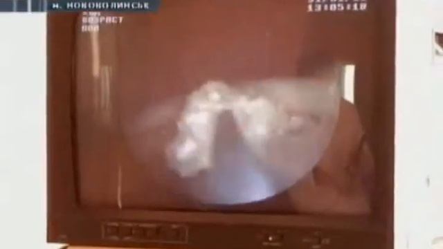 ВТ_Новий апарат для урологів.mp4 смотреть онлайн