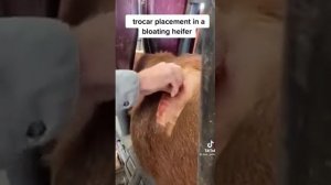 Тимпания. Прокол рубца