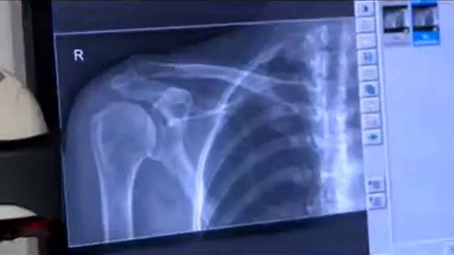 "600 секунд о здоровье и красоте" - анонс передачи 9 октября 2016 смотреть онлайн