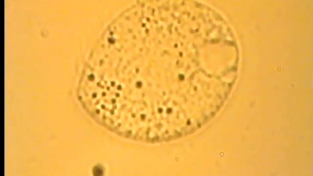 Инфузория Chilodonella uncinata смотреть онлайн
