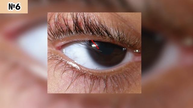 10 Особенностей Тела, Которые Встречаются Только у 5 % Людей смотреть онлайн