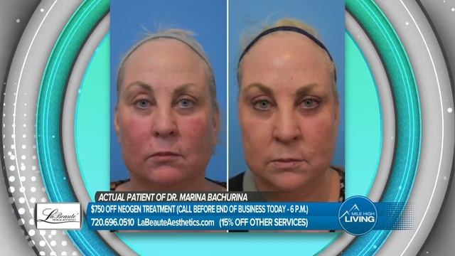 La Beaute Aesthetics: $750 Off Neogen Treatment