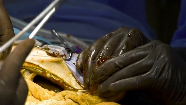 Overcoming a large abdominal mass called Leiomyosarcoma in a Shih Tzu - Episode 16 смотреть онлайн