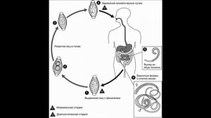 Власоглав Человеческий (Trichocephalus trichiurus) Морфология, Жизненный Цикл, Симптомы, Диагностик