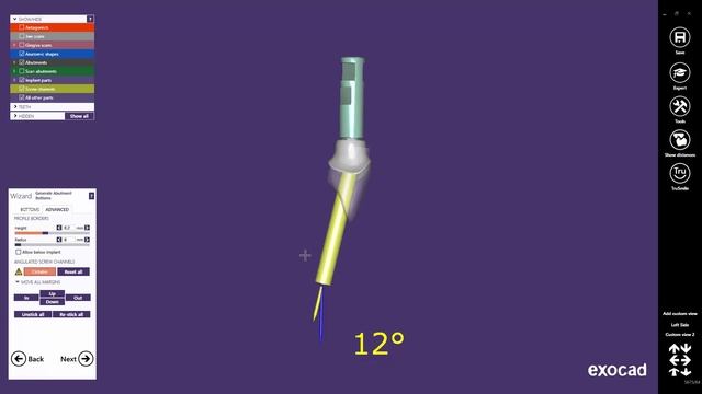 exocad Quick Guide: Angulated Screw Channel смотреть онлайн
