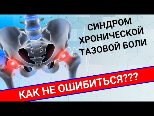 СИНДРОМ ХРОНИЧЕСКОЙ ТАЗОВОЙ БОЛИ: как не ошибиться? смотреть онлайн