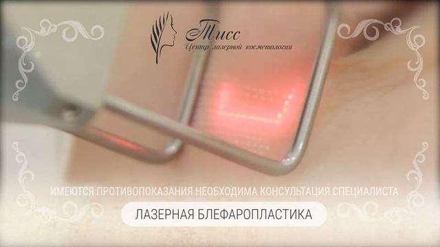 TISS Тисс_лазерная блефаропластика смотреть онлайн