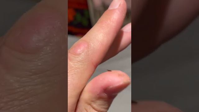 бетилид, микро оса, смотреть онлайн