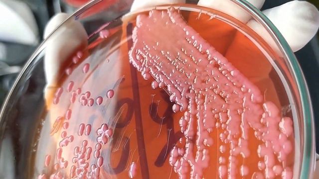 Klebsiella colony morphology on macConkey agar - Blood agar (Clear explanation with live video) смотреть онлайн