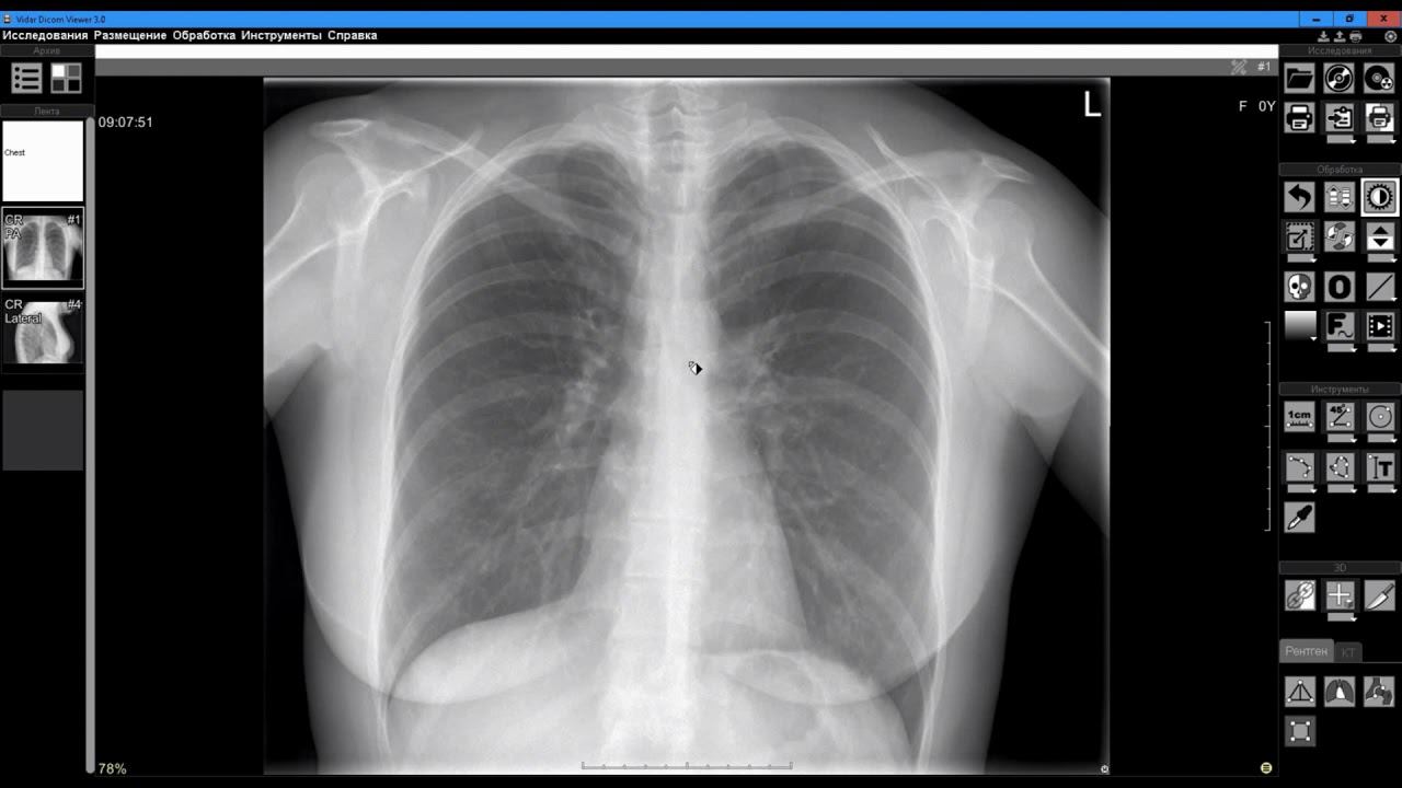 Запись исследований смотреть онлайн