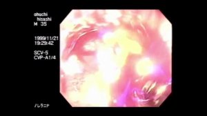 История Хисаши Оучи: Лечение или Пытка?