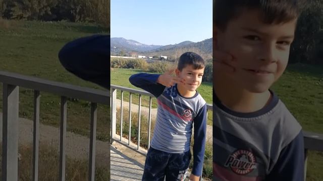 Contra el cáncer infantil. Hospital de San PAU Barcelona.(2) смотреть онлайн