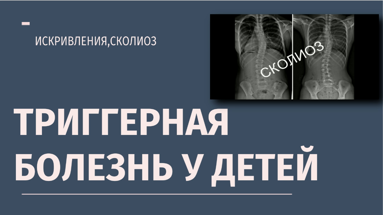 Миофасциальный синдром в детском возрасте.