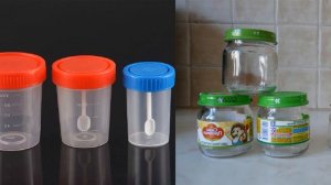 анализ кала на яйца глистов