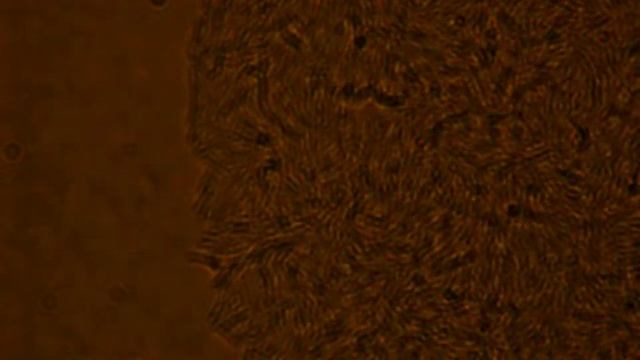 Growing colony of bacillus subtilis 168 смотреть онлайн