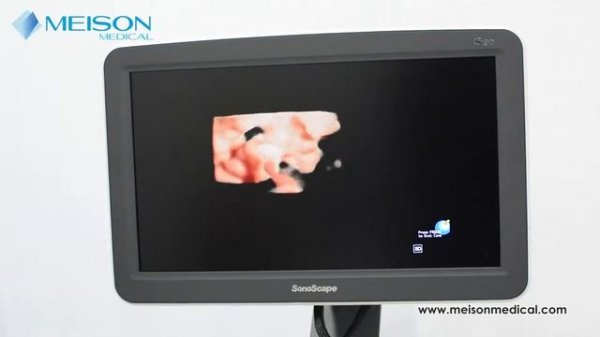 УЗИ-АППАРАТ SONOSCAPE S30