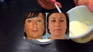 ПРОСТО СОДА И КЕФИР Сильно Отбеливает и Омолаживает Лицо Маска от Морщин и Пятен