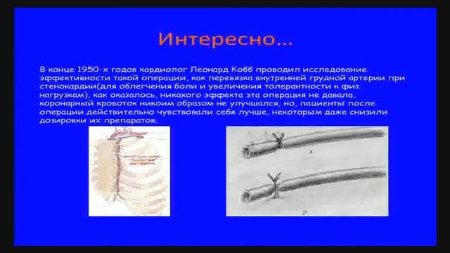 Школа гл. кардиолога "Доказательная медицина в практике кардиолога и терапевта" Шугушев З.Х. смотреть онлайн