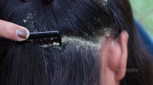 Combing Dandruff Satisfying - Dandruff Removal # 2190