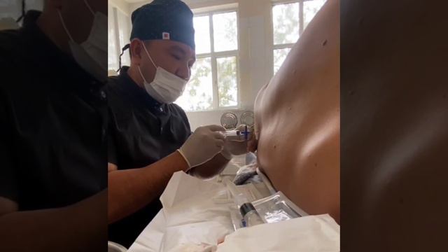 Эпидуральная анестезия. смотреть онлайн