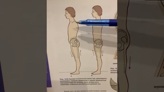 МТД работа с мышцами тазового дна смотреть онлайн