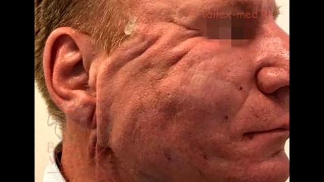 Нити для лица Dr Beauty смотреть онлайн