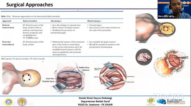 Diskusi Ilmiah Neuro-Onkologi смотреть онлайн