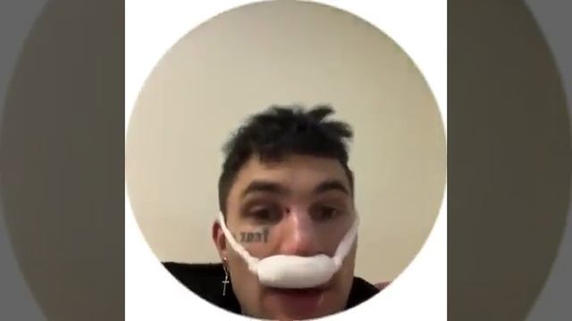 ПИНКУ СЛОМАЛИ НОС смотреть онлайн