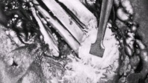 Какой была медицина в СОВЕТСКОМ СОЮЗЕ? Врачи СССР.