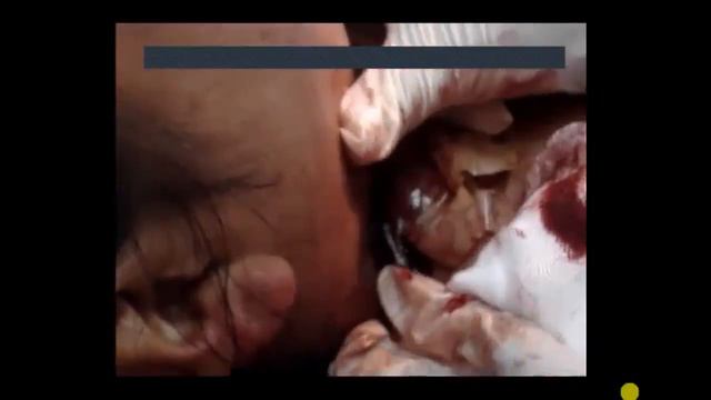 CLASE CIRUGIA II смотреть онлайн