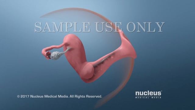 Pap and HPV Testing смотреть онлайн