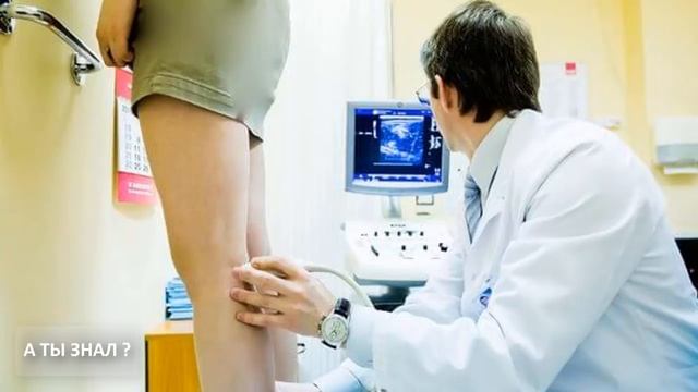 ИНСУЛЬТ, ИНФАРКТ , ВАРИКОЗ от ПРОТИВОЗАЧАТОЧНЫХ ТАБЛЕТОК смотреть онлайн