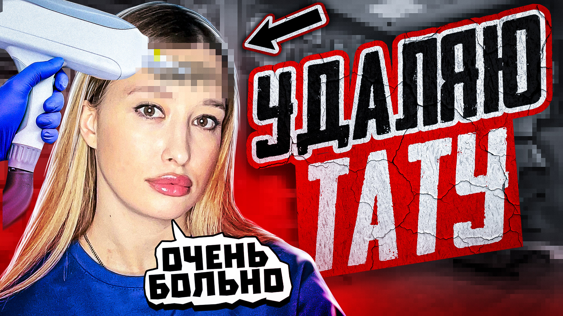 УДАЛЯЮ ТАТУ! смотреть онлайн