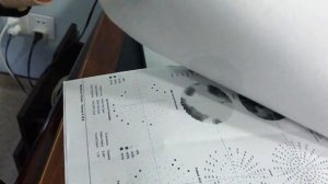 Лечение атрофии зрительного нерва